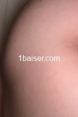 Fandecurvy